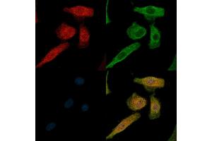 Phospho-IL4R/CD124 (Tyr497) Antibody staining A549 cells(H2O2 treatment) by IF/ICC. (IL4 Receptor 抗体  (pTyr497))