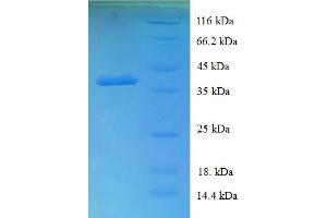 SDS-PAGE (SDS) image for UBX Domain Protein 11 (UBXN11) (AA 38-146), (partial) protein (GST tag) (ABIN5709169)