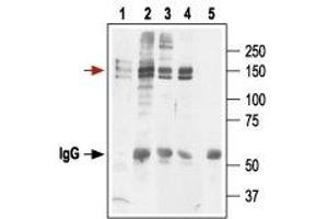 Immunoprecipitation (IP) image for anti-Potassium Voltage-Gated Channel, Subfamily H (Eag-Related), Member 2 (KCNH2) (AA 430-445), (Extracellular) antibody (ABIN7043545)