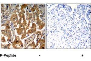 Image no. 1 for anti-Adducin 1 (Alpha) (ADD1) (pSer726) antibody (ABIN196918) (alpha Adducin 抗体  (pSer726))