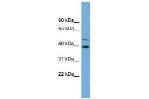 WB Suggested Anti-C21orf58 Antibody Titration: 0. (C21orf58 抗体  (N-Term))