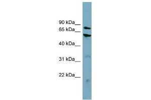 CPT1B antibody used at 1 ug/ml to detect target protein.