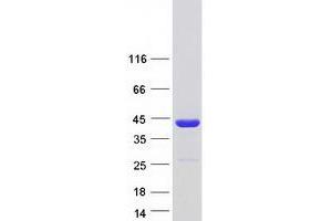 Western Blotting (WB) image for Nascent Polypeptide Associated Complex alpha 1 (NACa1) (Transcript Variant 2) protein (Myc-DYKDDDDK Tag) (ABIN2726836)