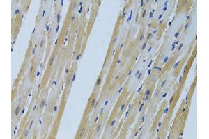 Immunohistochemistry of paraffin-embedded mouse heart using FHL2 antibody (ABIN1872694) at dilution of 1:100 (40x lens). (FHL2 抗体)