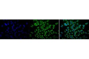 Immunocytochemistry/Immunofluorescence analysis using Mouse Anti-GRP78 Monoclonal Antibody, Clone 1H11-1H7 (ABIN863112). (GRP78 抗体)