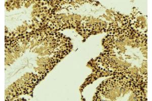 ABIN6269000 at 1/100 staining Mouse testis tissue by IHC-P. (Cyclin E2 抗体  (C-Term))