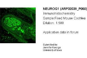 Sample Type: Mouse CochleaDilution: 1:500 (Neurogenin 1 抗体  (C-Term))