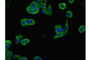 Immunofluorescence (IF) image for anti-Neuronal Growth Regulator 1 (NEGR1) (AA 1-196) antibody (ABIN7161366)