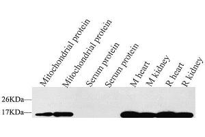 Western Blot analysis of various samples using COX4I1 Polyclonal Antibody at dilution of 1:1500. (COX IV 抗体)