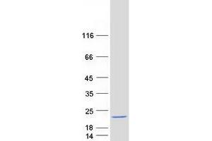 Western Blotting (WB) image for SCP2 Sterol-Binding Domain Containing 1 (SCP2D1) protein (Myc-DYKDDDDK Tag) (ABIN2715484)