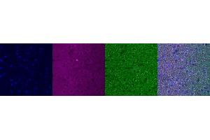 Immunohistochemistry (IHC) image for anti-Insulin-Like Growth Factor Binding Protein 6 (IGFBP6) antibody (ABIN7456279) (IGFBP6 抗体)