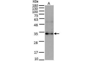 WB Image Sample (15 ug of whole cell lysate) A: HUVEC antibody diluted at 1:5000 (FGF10 抗体)