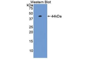 Western blot analysis of the recombinant protein. (HFE2 抗体  (AA 29-401))