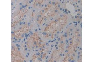 Used in DAB staining on fromalin fixed paraffin- embedded kidney tissue (PLCH2 抗体  (AA 1-257))