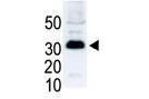 Image no. 1 for anti-SNAIL (SNAI1) (N-Term) antibody (ABIN357449)