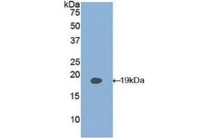 Detection of Recombinant PLAA, Human using Polyclonal Antibody to Phospholipase A2 Activating Protein (PLAP) (PLAA 抗体  (AA 162-312))