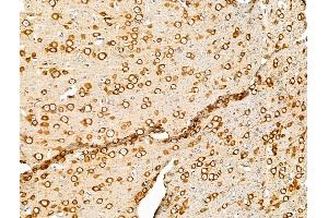 ABIN7094672 and ABIN7098723 at 1/100 staining Rat brain tissue by IHC-P. (PURA 抗体  (Internal Region))