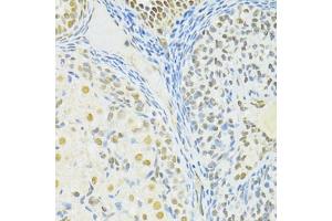Immunohistochemistry of paraffin-embedded rat ovary using BRCA1 antibody (ABIN6291827) at dilution of 1:100 (40x lens). (BRCA1 抗体)