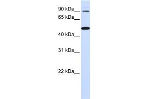 WB Suggested Anti-RHBDF1 Antibody Titration:  0. (RHBDF1 抗体  (N-Term))