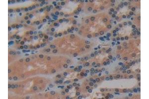 Immunohistochemistry (IHC) image for anti-Synuclein, gamma (Breast Cancer-Specific Protein 1) (SNCG) (AA 1-121) antibody (ABIN7429343)