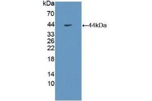 Western blot analysis of recombinant Human GHR. (Growth Hormone Receptor 抗体  (AA 315-574))