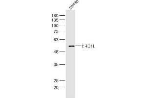 SW480 lysates probed with ERO1L Polyclonal Antibody, Unconjugated  at 1:300 dilution and 4˚C overnight incubation. (ERO1L 抗体  (AA 321-420))