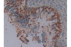 Immunohistochemistry (IHC) image for anti-serpin Peptidase Inhibitor, Clade B (Ovalbumin), Member 3 (SERPINB3) (AA 1-210) antibody (ABIN7433564)