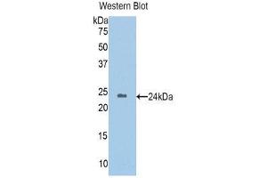 Western Blotting (WB) image for anti-Homogentisate 1,2-Dioxygenase (HGD) (AA 8-205) antibody (ABIN1176266) (HGD 抗体  (AA 8-205))