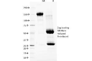 SDS-PAGE Analysis Purified Nuclear Membrane Marker Mouse Monoclonal Antibody (NM97). (Nuclear Membrane Marker 抗体)