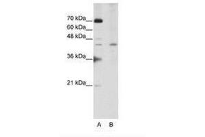 Image no. 3 for anti-Surfeit 6 (SURF6) (AA 191-240) antibody (ABIN202343) (SURF6 抗体  (AA 191-240))