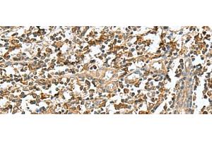 Immunohistochemistry of paraffin-embedded Human tonsil tissue using RAB23 Polyclonal Antibody at dilution of 1:50(x200) (RAB23 抗体)