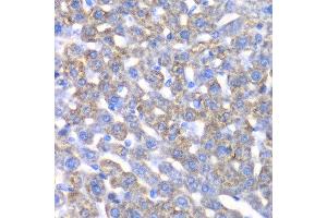 Immunohistochemistry of paraffin-embedded mouse liver using CCBL1 antibody at dilution of 1:100 (x40 lens). (CCBL1 抗体)
