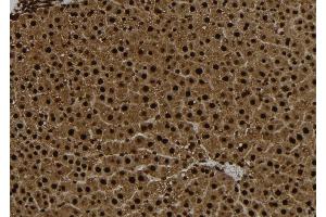 ABIN6267104 at 1/100 staining Rat liver tissue by IHC-P. (CENPA 抗体  (pSer7))
