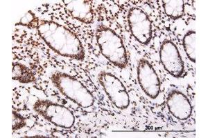 Image no. 1 for anti-Suppressor of Cytokine Signaling 3 (SOCS3) (AA 1-226) antibody (ABIN465973) (SOCS3 抗体  (AA 1-226))