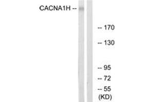 Western Blotting (WB) image for anti-Calcium Channel, Voltage-Dependent, T Type, alpha 1H Subunit (CACNA1H) (AA 462-511) antibody (ABIN2890690) (CACNA1H 抗体  (AA 462-511))