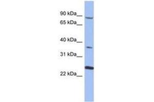 Image no. 1 for anti-Membrane Protein, Palmitoylated 3 (MAGUK P55 Subfamily Member 3) (MPP3) (AA 35-84) antibody (ABIN6744048) (MPP3 抗体  (AA 35-84))