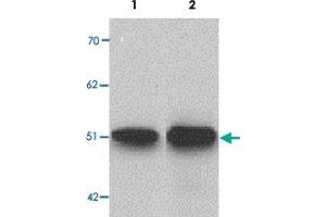 Western blot analysis of ZIP9 in HepG2 cell lysate with SLC39A9 polyclonal antibody  at 1 ug/mL (lane 1) and 2 ug/mL (lane 2). (SLC39A9 抗体  (N-Term))