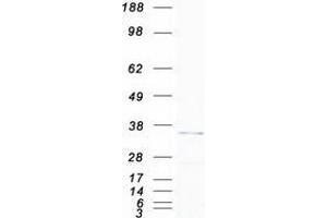 Western Blotting (WB) image for VAMP (Vesicle-Associated Membrane Protein)-Associated Protein A, 33kDa (VAPA) (Transcript Variant 2) protein (Myc-DYKDDDDK Tag) (ABIN2735169)