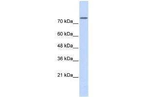 WB Suggested Anti-PLD2 Antibody Titration:  0. (Phospholipase D2 抗体  (Middle Region))