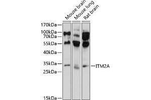 Western blot analysis of extracts of various cell lines, using ITM2A antibody (ABIN6128106, ABIN6142603, ABIN6142604 and ABIN6214624) at 1:1000 dilution. (ITM2A 抗体  (AA 1-263))