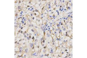 Immunohistochemistry (IHC) image for anti-Protein Phosphatase 2A Activator, Regulatory Subunit 4 (PPP2R4) antibody (ABIN1874229) (PPP2R4 抗体)