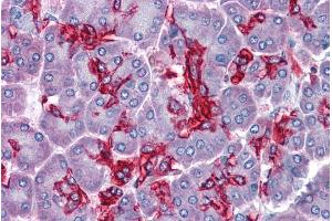Immunohistochemistry (IHC) image for anti-Abhydrolase Domain Containing 5 (ABHD5) (Internal Region) antibody (ABIN190850)