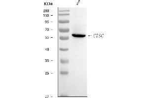 Western blot analysis of CTSC using anti-CTSC antibody (ABIN7600695).