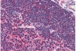 Human Thymus (formalin-fixed, paraffin-embedded) stained with UNC13D antibody ABIN290189 at 2. (UNC13D 抗体  (AA 967-980))