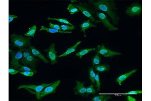 Immunofluorescence of monoclonal antibody to HECTD2 on HeLa cell. (HECTD2 抗体  (AA 331-440))