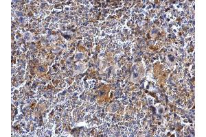 IHC-P Image BTK antibody [C1C3] detects BTK protein at cytosol on mouse spleen by immunohistochemical analysis. (BTK 抗体  (C-Term))