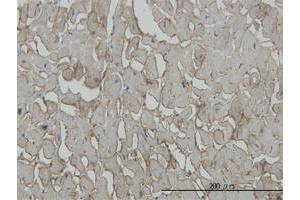 Immunoperoxidase of monoclonal antibody to SGCB on formalin-fixed paraffin-embedded human heart.