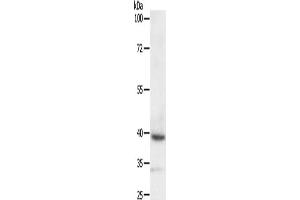 Gel: 10 % SDS-PAGE, Lysate: 40 μg, Lane: SKOV3 cells, Primary antibody: ABIN7129267(DTX3 Antibody) at dilution 1/200, Secondary antibody: Goat anti rabbit IgG at 1/8000 dilution, Exposure time: 10 minutes (Deltex Homolog 3 抗体)