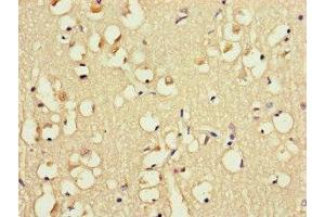 Immunohistochemistry of paraffin-embedded human brain tissue using ABIN7152623 at dilution of 1:100 (FABP7 抗体  (AA 2-132))