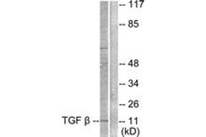 Western blot analysis of extracts from COS7 cells, using TGF beta3 Antibody. (TGFB3 抗体  (AA 261-310))